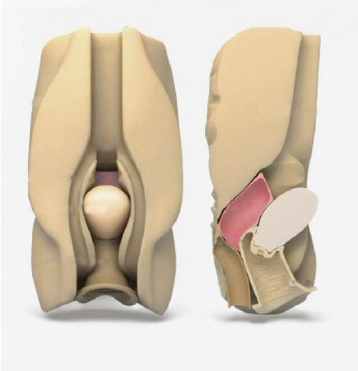 महिला पेट के अंदरूनी अंगों योनि कल्लोडिएंटिस लैप्रोस्कोपिक सिम्युलेटर